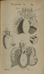 Planche VI - L'Anatomie du corps humain avec ses maladies, & les remedes pour les guerir. Nouvelle e [...]