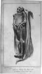Planche 2. cadavre inhumé le 7 février 1828 et exhumé le 24 avril 1828 - Traités des exhumations jur [...]