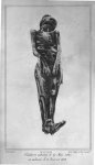 Planche 3. cadavre inhumé le 27 mai 1827 et exhumé le 21 janvier 1828 - Traités des exhumations juri [...]