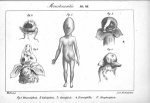Planche VII. Monstruosités. Fig. 1. Rhinencéphale / Fig. 2. Edocéphale / Fig. 3. Opocéphale / Fig. 4 [...]