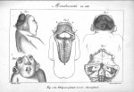 Planche VIII. Monstruosités. Fig. 1 et 2. Thlipsencéphale / Fig. 3 à 5. Anencéphale - Histoire génér [...]