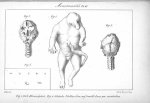 Planche XI. Monstruosités. Fig. 1 à 3. Hémiacéphale / Fig. 4. Globules Vitellins d'un oeuf troublé d [...]