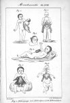 Planche XVIII. Monstruosités. Fig. 1. Hétéropage / Fig. 2 et 3. Hétérodyme / Fig. 4 à 6. Hétéradelph [...]