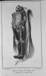 Cadavre inhumé le 7 février 1828 et exhumé le 24 avril 1828 - Traité de médecine légale, suivi du tr [...]