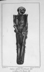 Cadavre inhumé le 22 décembre 1826 et exhumé le 22 janvier 1828 - Traité de médecine légale, suivi d [...]