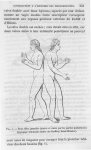 Fig. 1. Deux filles jumelles jointes et unies par les parties postérieures (pygopage bi femelle adul [...]