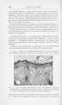 Fig. 1. — Lesions de la peau : disparition des cônes interpapillaires et atrophie de l’épithélium ;  [...]