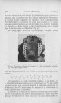 Fig. 49. — Quatrièmes molaires supérieures symétriques chez Cebus appella (Linné). Collections d’Ana [...]