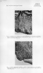 [P. Le Gac et Coll.] Fig. 3. - Histologie de la bordure de l'escarre-papillomatose du revêtement mal [...]